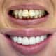 Slider image (9) Astra Dental Clinic